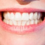 Piękne zdrowe zęby dodatkowo olśniewający uroczy uśmiech to powód do płenego uśmiechu.